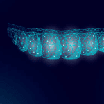 How Much Are Invisalign in Canada